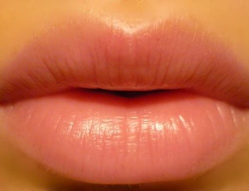 Prevent Chapped Lips