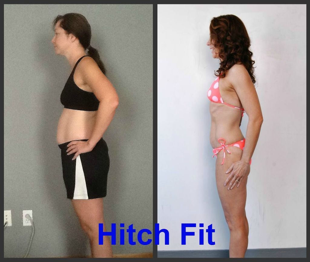 Andrea W. Before and After Side