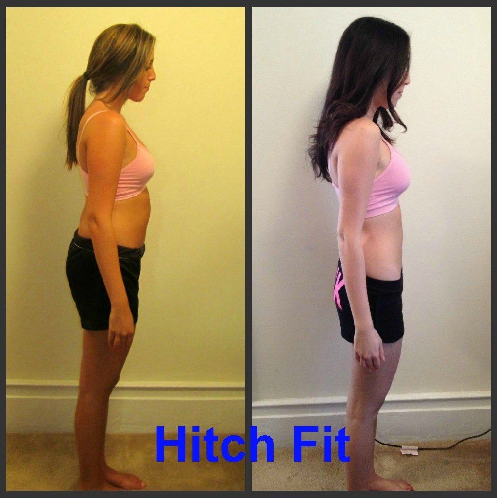 Rachel Before and After Side
