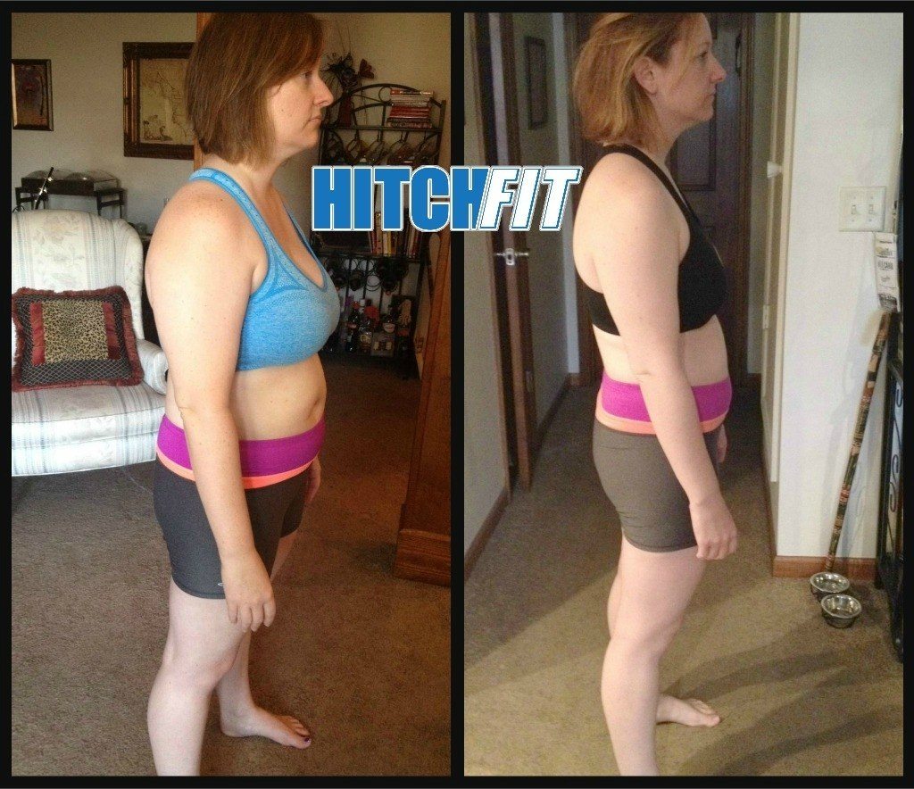 Laurel M. Before and After Side