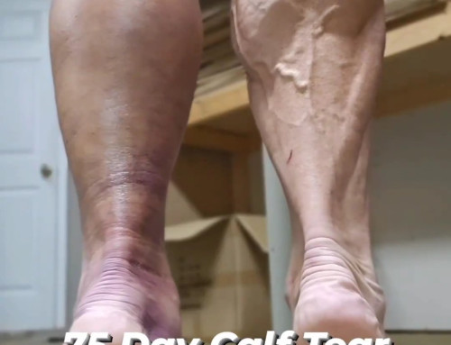 How To Heal A Calf Tear Quickly – 75 Day Recovery Schedule